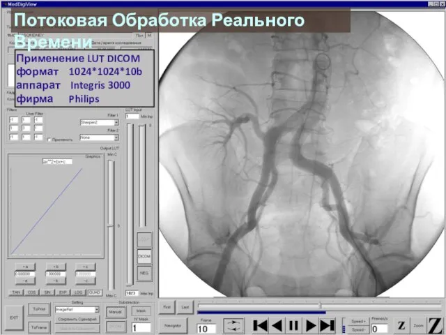 Применение LUT DICOM формат 1024*1024*10b аппарат Integris 3000 фирма Philips Потоковая Обработка Реального Времени