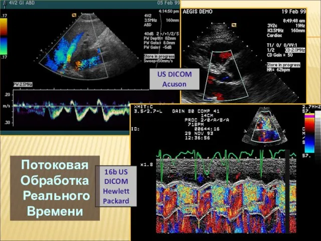 16b US DICOM Hewlett Packard US DICOM Acuson Потоковая Обработка Реального Времени