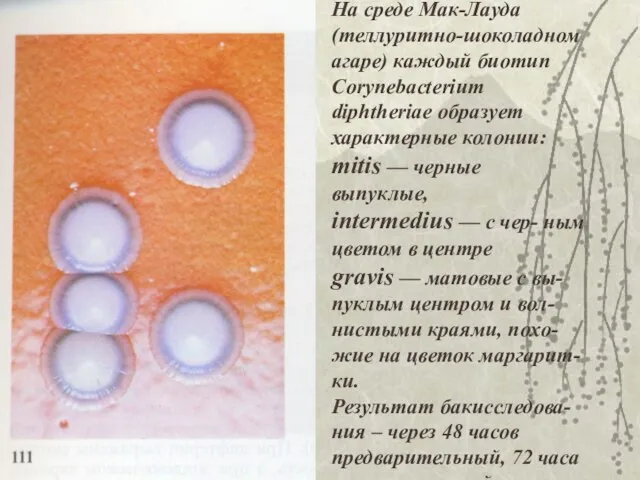 На среде Мак-Лауда (теллуритно-шоколадном агаре) каждый биотип Corynebacterium diphtheriae образует характерные