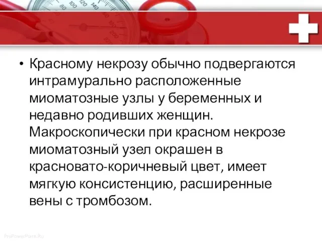 Красному некрозу обычно подвергаются интрамурально расположенные миоматозные узлы у беременных и