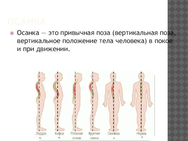 ОСАНКА Осанка — это привычная поза (вертикальная поза, вертикальное положение тела