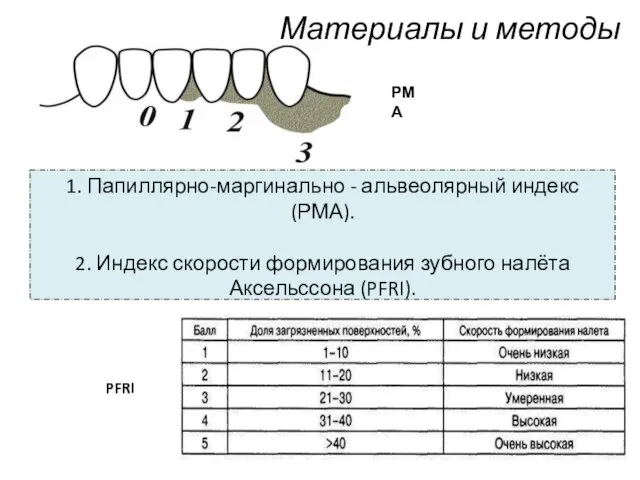 Материалы и методы 1. Папиллярно-маргинально - альвеолярный индекс (РМА). 2. Индекс