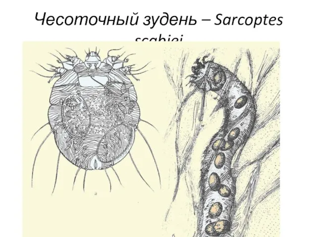 Чесоточный зудень – Sarcoptes scabiei