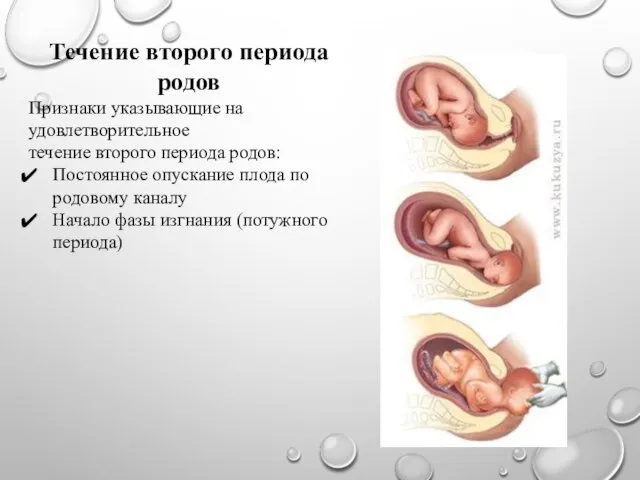 Течение второго периода родов Признаки указывающие на удовлетворительное течение второго периода