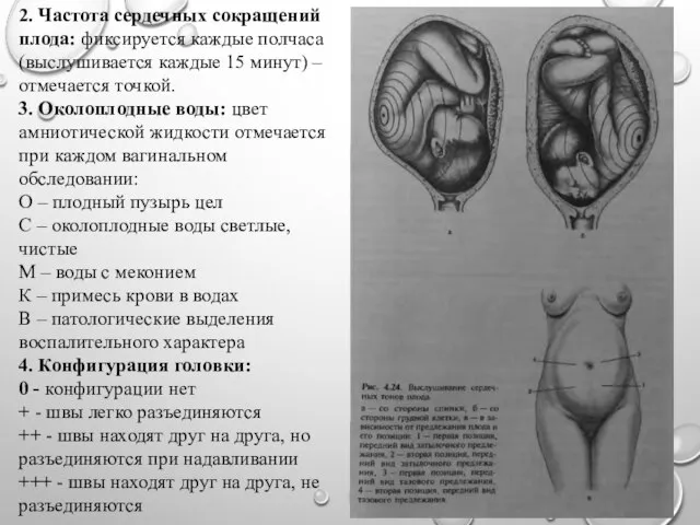 2. Частота сердечных сокращений плода: фиксируется каждые полчаса (выслушивается каждые 15