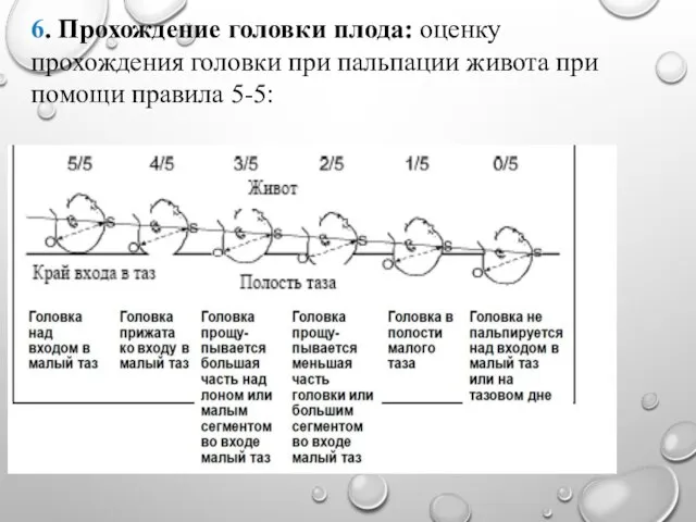 6. Прохождение головки плода: оценку прохождения головки при пальпации живота при помощи правила 5-5: