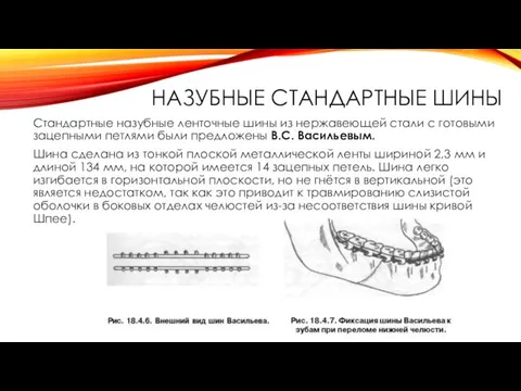 НАЗУБНЫЕ СТАНДАРТНЫЕ ШИНЫ Стандартные назубные ленточные шины из нержавеющей стали с