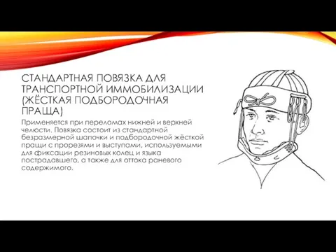 СТАНДАРТНАЯ ПОВЯЗКА ДЛЯ ТРАНСПОРТНОЙ ИММОБИЛИЗАЦИИ (ЖЁСТКАЯ ПОДБОРОДОЧНАЯ ПРАЩА) Применяется при переломах