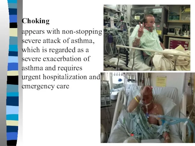 Choking appears with non-stopping severe attack of asthma, which is regarded