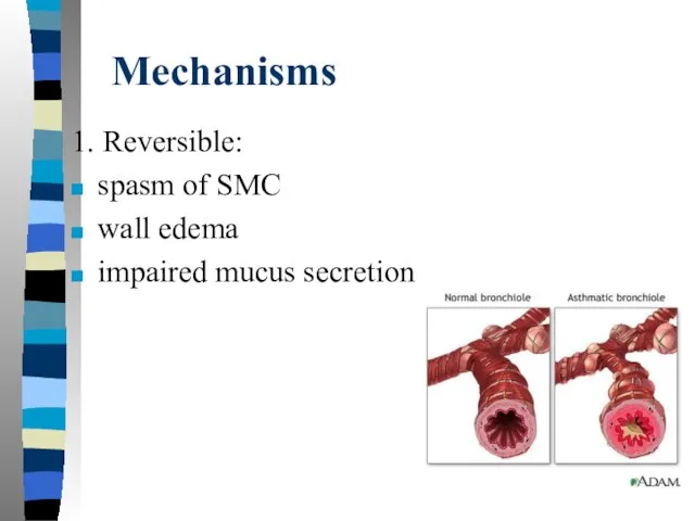 Mechanisms 1. Reversible: spasm of SMC wall edema impaired mucus secretion