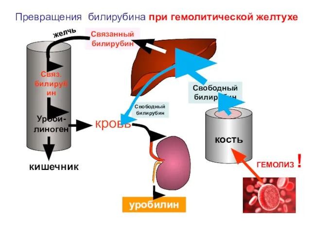 Свободный билирубин Связ. билирубин Уроби-линоген кровь уробилин Связанный билирубин кишечник Превращения