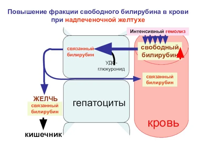 свободный билирубин связанный билирубин УДФ-глюкуронид ЖЕЛЧЬ связанный билирубин Повышение фракции свободного