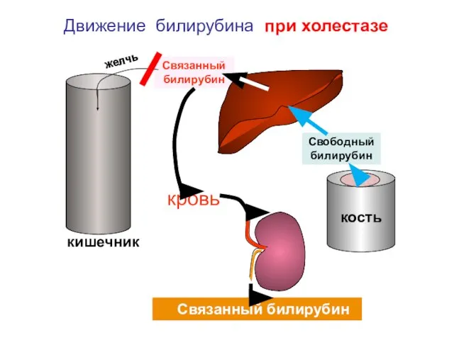 кровь Связанный билирубин Связанный билирубин кишечник Движение билирубина при холестазе желчь Свободный билирубин кость