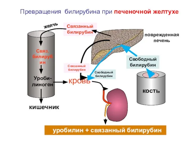 Свободный билирубин Связ. билирубин Уроби-линоген кровь уробилин + связанный билирубин Связанный