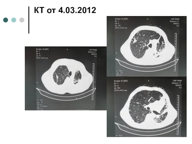 КТ от 4.03.2012