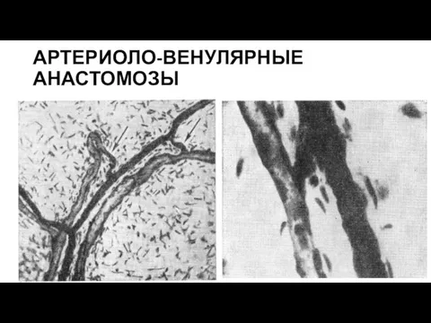 АРТЕРИОЛО-ВЕНУЛЯРНЫЕ АНАСТОМОЗЫ