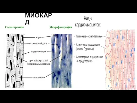 МИОКАРД