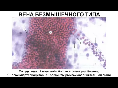 ВЕНА БЕЗМЫШЕЧНОГО ТИПА Сосуды мягкой мозговой оболочки: I – венула; II