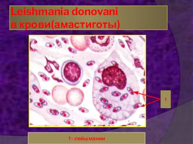 Leishmania donovani в крови(амастиготы) 1 1- лейшмании