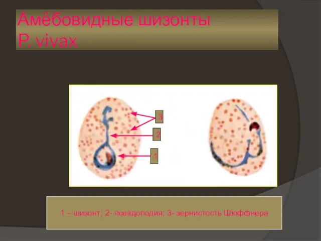 Амёбовидные шизонты P. vivax 1 2 3 1 – шизонт; 2- псевдоподия; 3- зернистость Шюффнера