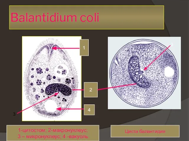 Balantidium coli 1 2 4 1-цитостом; 2-макронуклеус; 3 – микронуклеус; 4 -вакуоль Циста балантидия 3 3