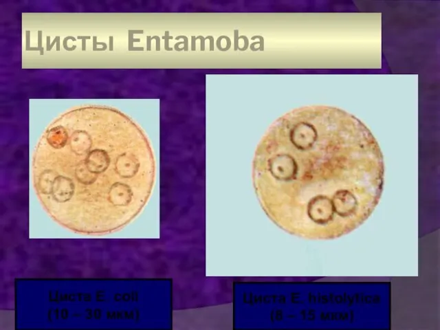 Цисты Entamoba Циста E. coli (10 – 30 мкм) Циста E. histolytica (8 – 15 мкм)