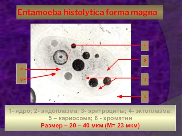 Entamoeba histolytica forma magna 1 2 3 4 1- ядро; 2-