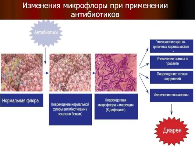 Изменения микрофлоры при применении антибиотиков