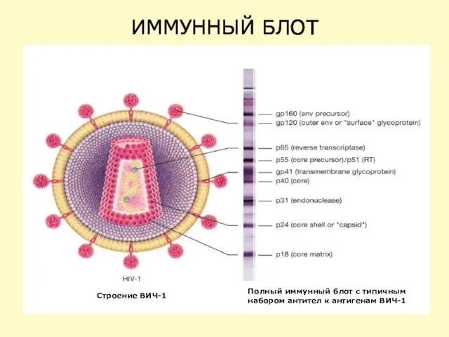 ИММУННЫЙ БЛОТ Строение ВИЧ-1 Полный иммунный блот с типичным набором антител к антигенам ВИЧ-1