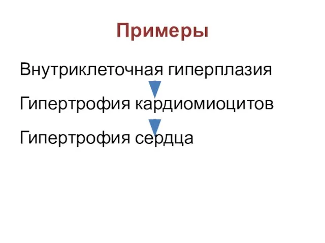 Примеры Внутриклеточная гиперплазия Гипертрофия кардиомиоцитов Гипертрофия сердца