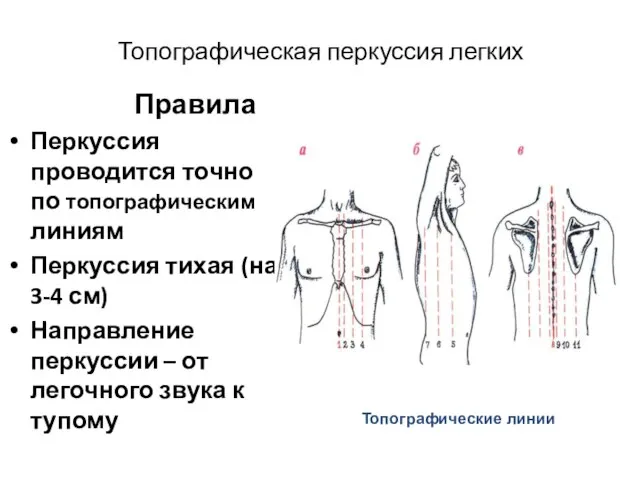 Топографическая перкуссия легких Правила Перкуссия проводится точно по топографическим линиям Перкуссия