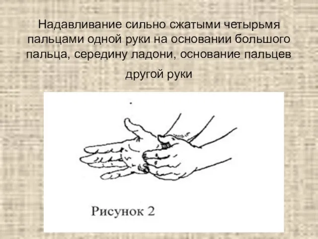 Надавливание сильно сжатыми четырьмя пальцами одной руки на основании большого пальца,