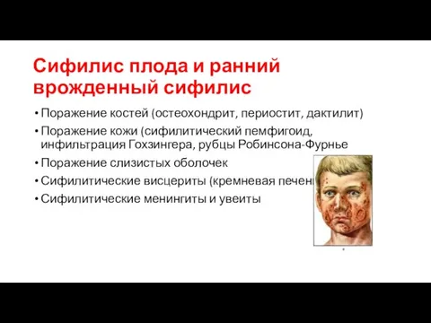 Сифилис плода и ранний врожденный сифилис Поражение костей (остеохондрит, периостит, дактилит)