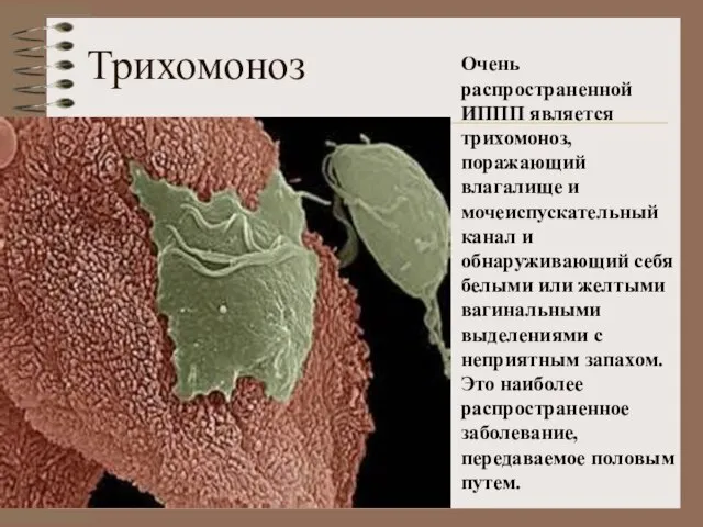 Трихомоноз Очень распространенной ИППП является трихомоноз, поражающий влагалище и мочеиспускательный канал