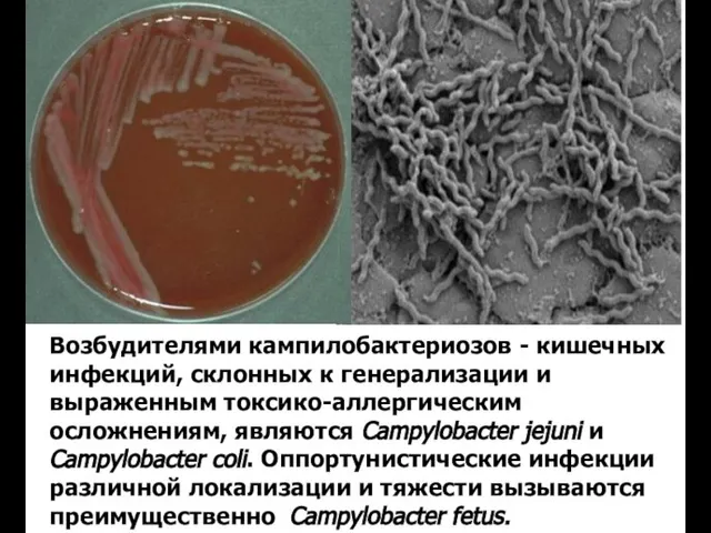 Возбудителями кампилобактериозов - кишечных инфекций, склонных к генерализации и выраженным токсико-аллергическим