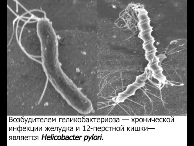 Возбудителем геликобактериоза — хронической инфекции желудка и 12-перстной кишки— является Helicobacter pylori.