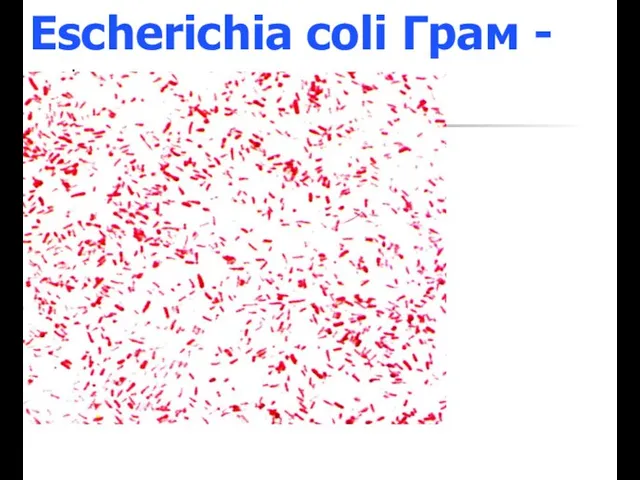Escherichia coli Грам -