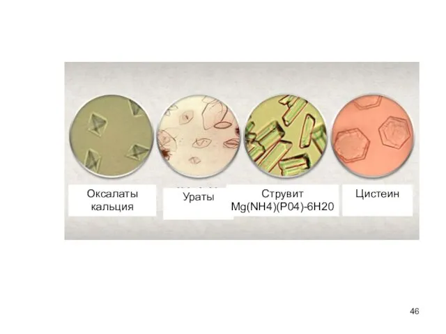Оксалаты кальция Ураты Цистеин Струвит Mg(NH4)(P04)-6H20