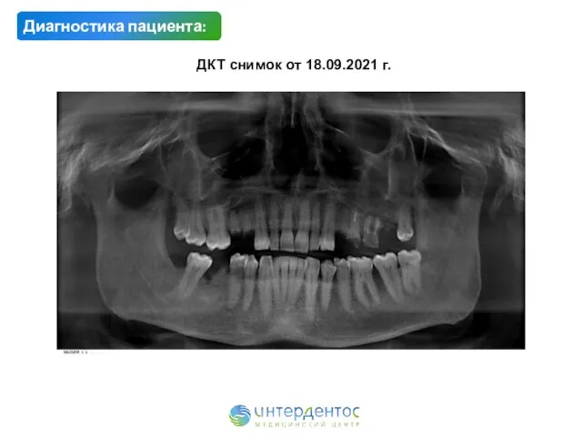 Диагностика пациента: ДКТ снимок от 18.09.2021 г.