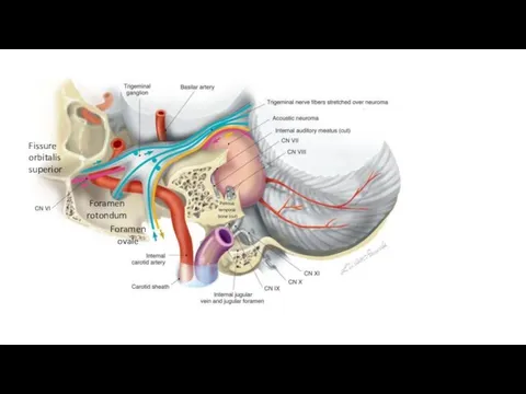 Fissure orbitalis superior Foramen rotondum Foramen ovale