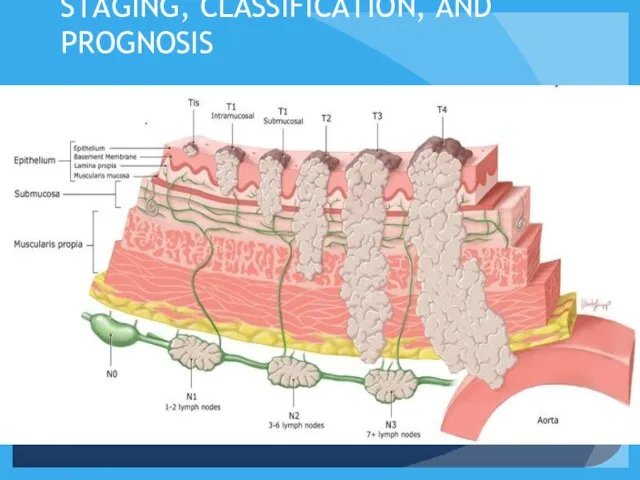 STAGING, CLASSIFICATION, AND PROGNOSIS