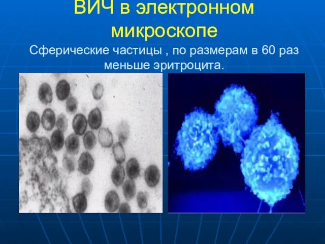 ВИЧ в электронном микроскопе Сферические частицы , по размерам в 60 раз меньше эритроцита.