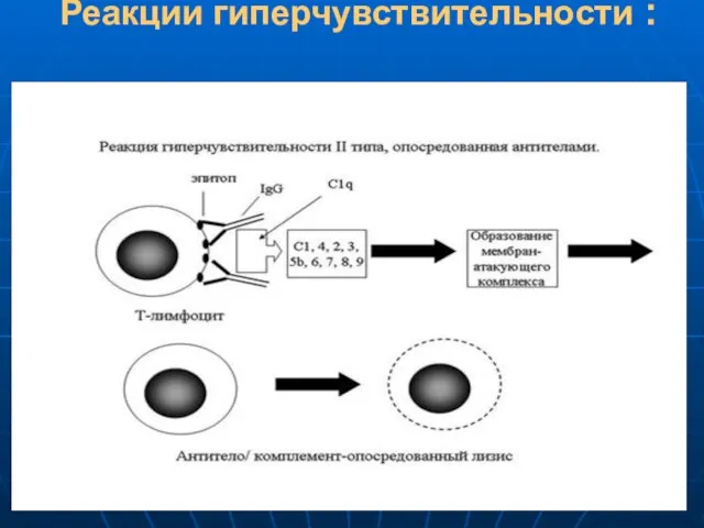 Реакции гиперчувствительности :