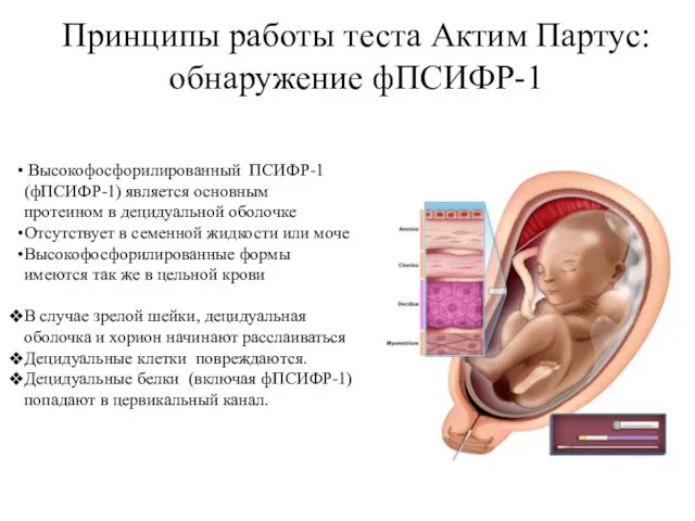 Принципы работы теста Актим Партус: обнаружение фПСИФР-1 Высокофосфорилированный ПСИФР-1 (фПСИФР-1) является