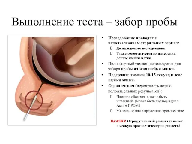 Выполнение теста – забор пробы Исследование проводят с использованием стерильных зеркал: