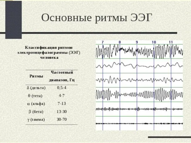 По частоте в ЭЭГ различают следующие типы ритмических составляющих: дельта-ритм (0,5-4