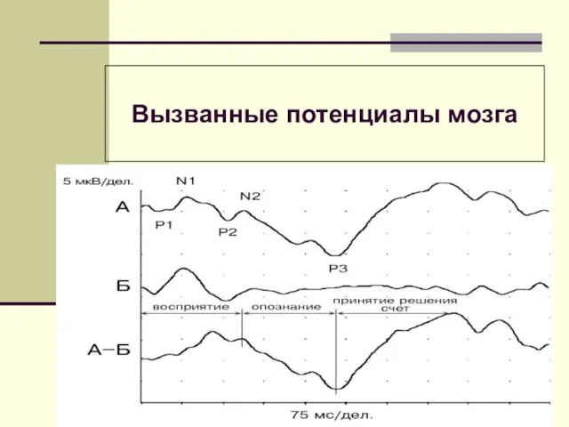 Вызванные потенциалы мозга