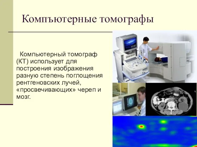 Компъютерные томографы Компьютерный томограф (КТ) использует для построения изображения разную степень