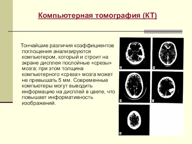 Тончайшие различия коэффициентов поглощения анализируются компьютером, который и строит на экране