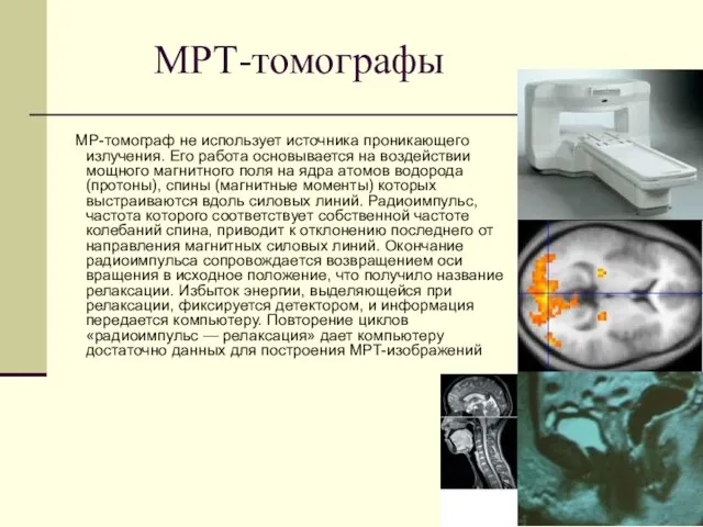 МРТ-томографы МР-томограф не использует источника проникающего излучения. Его работа основывается на